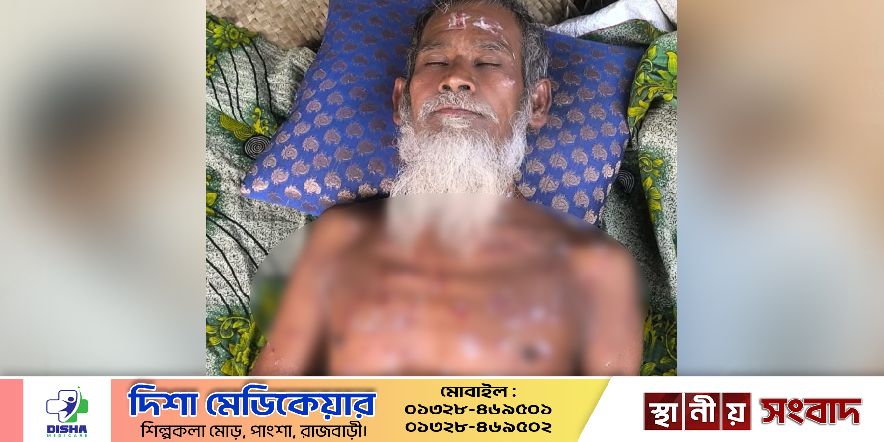 আসামির ছুড়া গুলিতে পথচারি গুলিবৃদ্ধ, দুই পুলিশ সদস্য আহত 